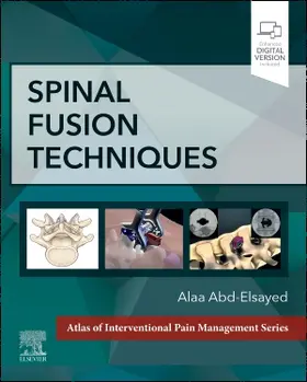 Abd-Elsayed |  Spinal Fusion Techniques | Buch |  Sack Fachmedien