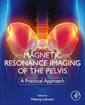 Lalwani |  Magnetic Resonance Imaging of the Pelvis | Buch |  Sack Fachmedien