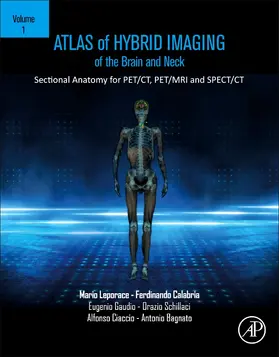 Gaudio |  Atlas of Hybrid Imaging Sectional Anatomy for PET/CT, PET/MRI and SPECT/CT Vol. 1: Brain and Neck | Buch |  Sack Fachmedien