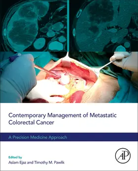 Ejaz / Pawlik |  Contemporary Management of Metastatic Colorectal Cancer | Buch |  Sack Fachmedien