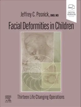 Posnick |  Facial Deformities in Children | Buch |  Sack Fachmedien