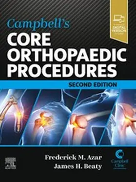 Azar MD / Beaty MD |  Campbell's Core Orthopaedic Procedures E-Book | eBook | Sack Fachmedien