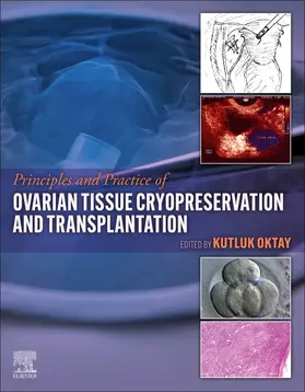 Oktay |  Principles and Practice of Ovarian Tissue Cryopreservation and Transplantation | Buch |  Sack Fachmedien