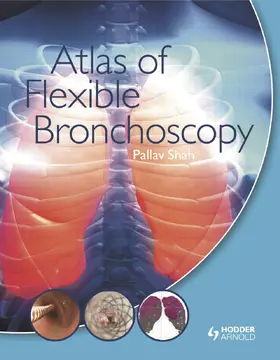 Shah |  Atlas of Flexible Bronchoscopy | Buch |  Sack Fachmedien