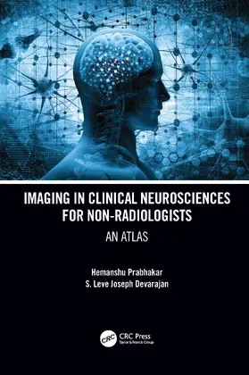 Prabhakar / Devarajan |  Imaging in Clinical Neurosciences for Non-Radiologists: An Atlas | Buch |  Sack Fachmedien