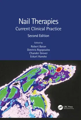 Baran / Rigopoulos / Grover |  Nail Therapies | Buch |  Sack Fachmedien