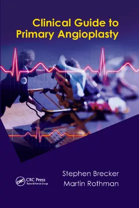 Brecker / Rothman | Clinical Guide to Primary Angioplasty | Buch | 978-0-367-38400-5 | sack.de