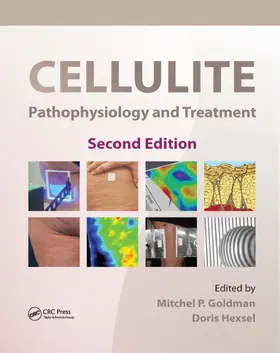 Goldman / Hexsel | Cellulite | Buch | 978-0-367-38418-0 | www2.sack.de