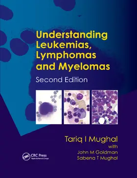 Goldman / Mughal |  Understanding Leukemias, Lymphomas and Myelomas | Buch |  Sack Fachmedien