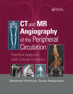 Mukherjee / Rajagopalan |  CT and MR Angiography of the Peripheral Circulation | Buch |  Sack Fachmedien