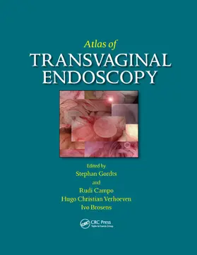 Gordts / Verhoeven / Campo |  Atlas of Transvaginal Endoscopy | Buch |  Sack Fachmedien