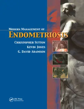 Sutton / Adamson / Jones |  Modern Management of Endometriosis | Buch |  Sack Fachmedien