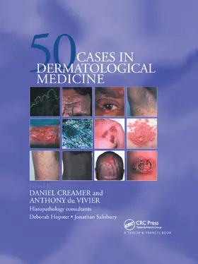 Creamer / du Vivier |  Fifty Dermatological Cases | Buch |  Sack Fachmedien