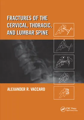 Vaccaro |  Fractures of the Cervical, Thoracic, and Lumbar Spine | Buch |  Sack Fachmedien