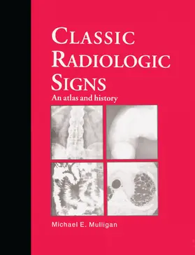 Mulligan |  Classic Radiologic Signs | Buch |  Sack Fachmedien