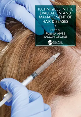Grimalt / Alves |  Techniques in the Evaluation and Management of Hair Disease | Buch |  Sack Fachmedien