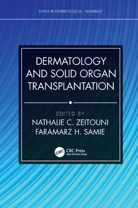 Zeitouni / Samie |  Dermatology and Solid Organ Transplantation | Buch |  Sack Fachmedien