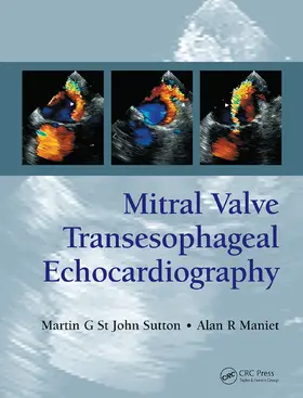 St. John Sutton / Maniet |  Mitral Valve Transesophageal Echocardiography | Buch |  Sack Fachmedien