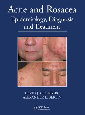 Goldberg / Berlin |  Acne and Rosacea | Buch |  Sack Fachmedien