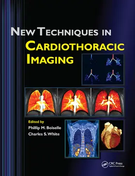 Boiselle / White | New Techniques in Cardiothoracic Imaging | Buch | 978-0-367-45296-4 | www2.sack.de