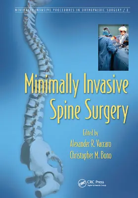 Vaccaro / Bono |  Minimally Invasive Spine Surgery | Buch |  Sack Fachmedien