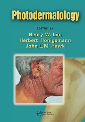 Lim / Honigsmann / Hawk | Photodermatology | Buch | 978-0-367-45319-0 | www2.sack.de