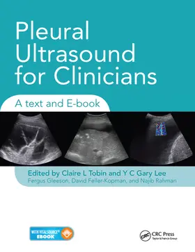 Tobin / Lee / Gleeson |  Pleural Ultrasound for Clinicians | Buch |  Sack Fachmedien