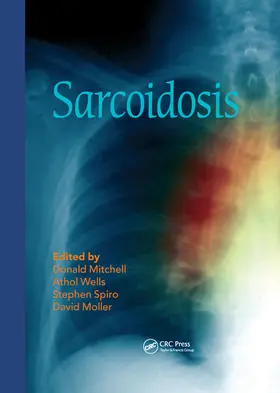Mitchell / Wells / Spiro |  Sarcoidosis | Buch |  Sack Fachmedien