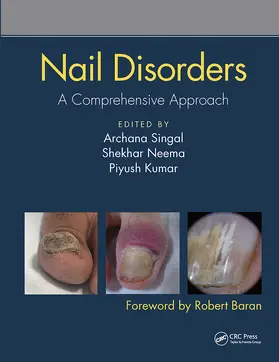 Singal / Neema / Kumar |  Nail Disorders | Buch |  Sack Fachmedien