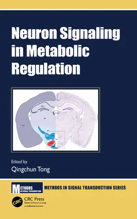 Tong |  Neuron Signaling in Metabolic Regulation | Buch |  Sack Fachmedien