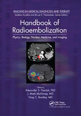 Bradley / Pasciak / McKinney |  Handbook of Radioembolization | Buch |  Sack Fachmedien