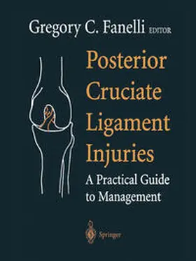 Fanelli |  Posterior Cruciate Ligament Injuries | eBook | Sack Fachmedien