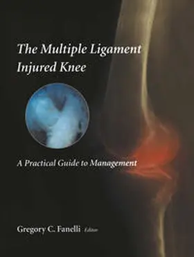 Fanelli |  The Multiple Ligament Injured Knee | eBook | Sack Fachmedien