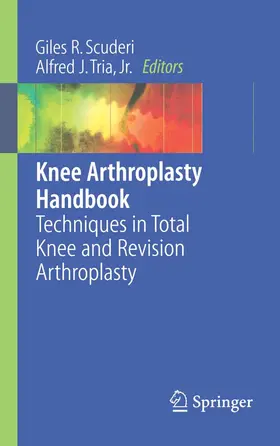 Scuderi / Tria | Knee Arthroplasty Handbook | E-Book | sack.de