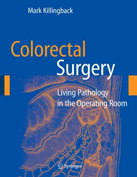 Killingback | Colorectal Surgery | E-Book | sack.de