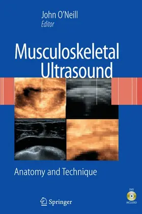 O'Neill |  Musculoskeletal Ultrasound | Buch |  Sack Fachmedien