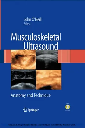 O'Neill / O’Neill | Musculoskeletal Ultrasound | E-Book | sack.de