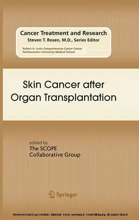 Stockfleth / Ulrich |  Skin Cancer after Organ Transplantation | eBook | Sack Fachmedien