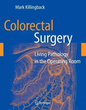 Killingback | Colorectal Surgery | Buch | 978-0-387-88033-4 | sack.de
