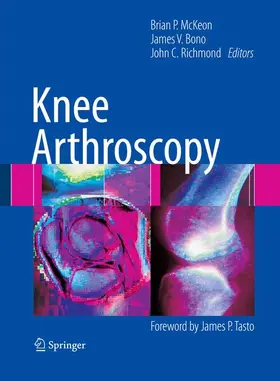McKeon / Richmond / Bono |  Knee Arthroscopy | Buch |  Sack Fachmedien