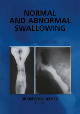 Jones |  Normal and Abnormal Swallowing | Buch |  Sack Fachmedien