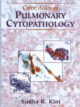 Kini | Color Atlas of Pulmonary Cytopathology | Buch | 978-0-387-95371-7 | sack.de