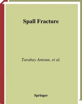 Antoun / Seaman / Utkin |  Spall Fracture | Buch |  Sack Fachmedien