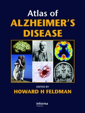Feldman |  Atlas of Alzheimer's Disease | Buch |  Sack Fachmedien