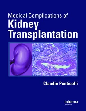 Ponticelli |  Medical Complications of Kidney Transplantation | Buch |  Sack Fachmedien