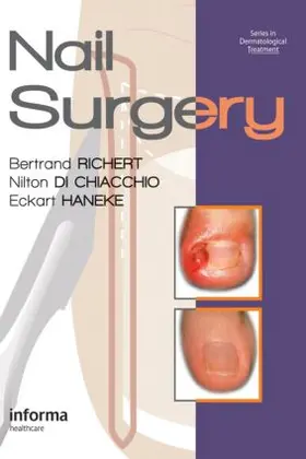 Richert / Haneke / Di Chiacchio |  Nail Surgery | Buch |  Sack Fachmedien
