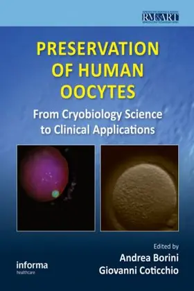 Borini / Coticchio |  Preservation of Human Oocytes | Buch |  Sack Fachmedien
