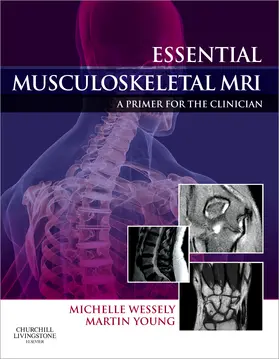 Wessely / Young |  Essential Musculoskeletal MRI | Buch |  Sack Fachmedien