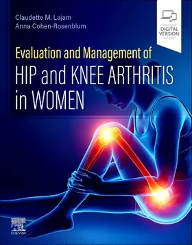 Lajam / Cohen-Rosenblum |  Evaluation and Management of Hip and Knee Arthritis in Women | Buch |  Sack Fachmedien