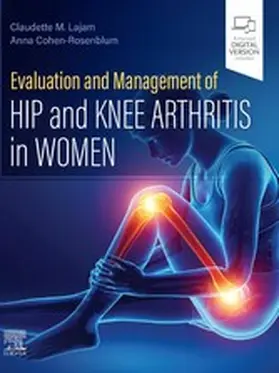 Cohen-Rosenblum |  Evaluation and Management of Hip and Knee Arthritis in Women | eBook | Sack Fachmedien